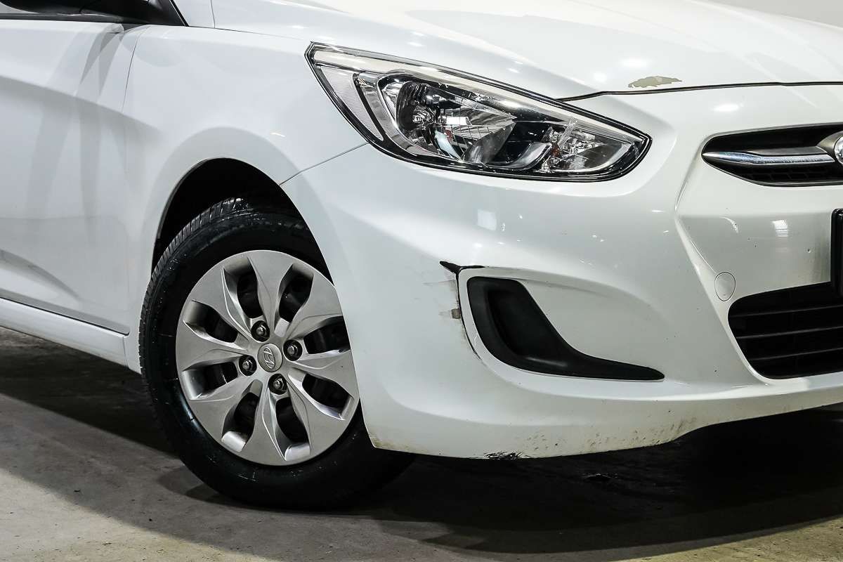2016 Hyundai Accent Active RB3